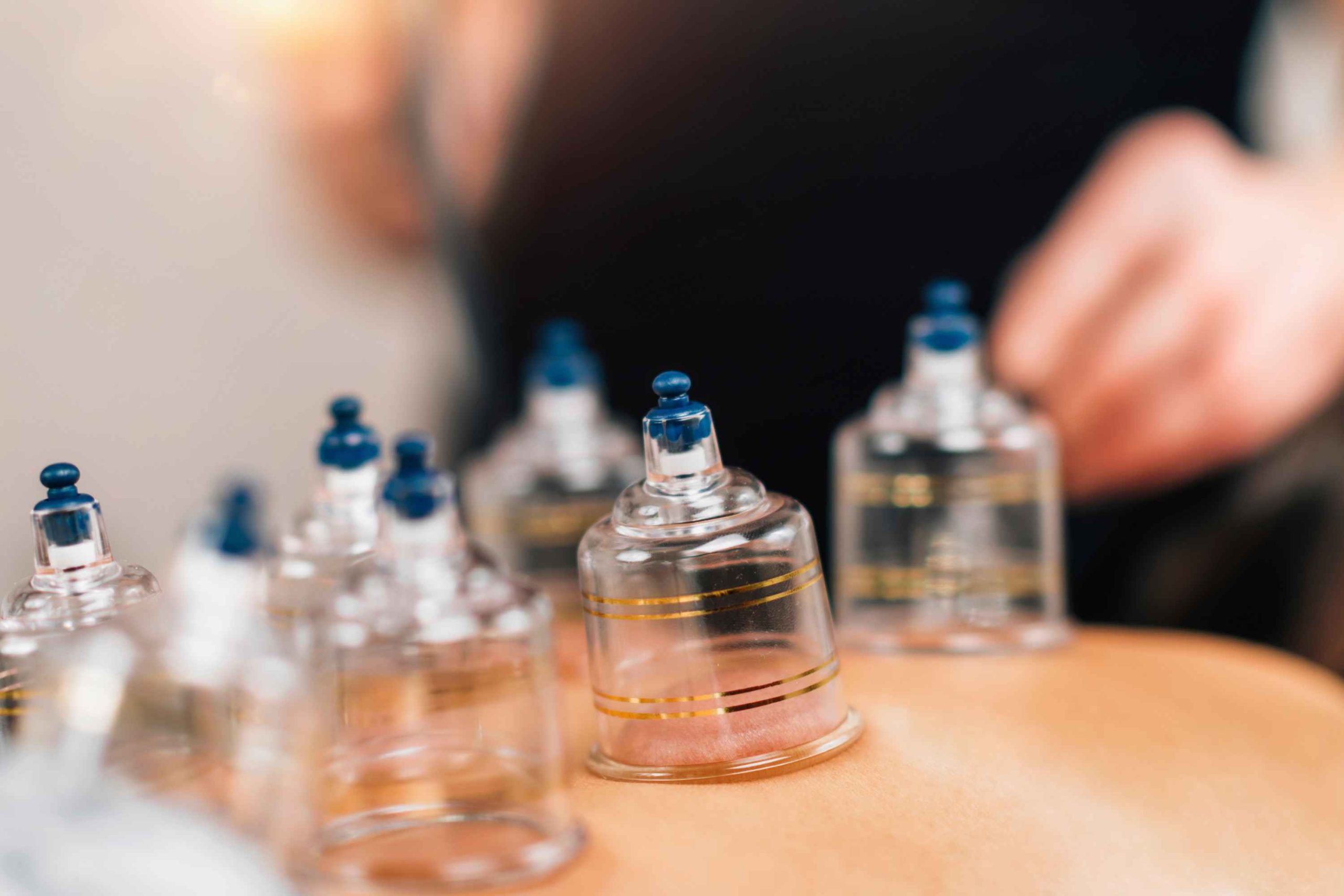 Manfaat Bekam untuk Kesehatan